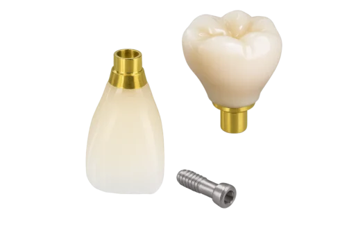 Cement-Retained / Screw-Retained Implant Restoration