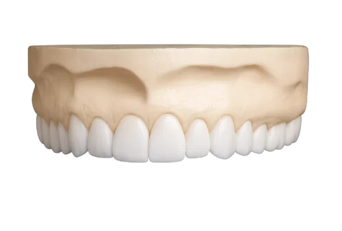 Diagnostic Wax-Ups