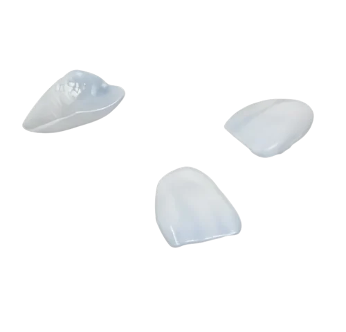 Veneers